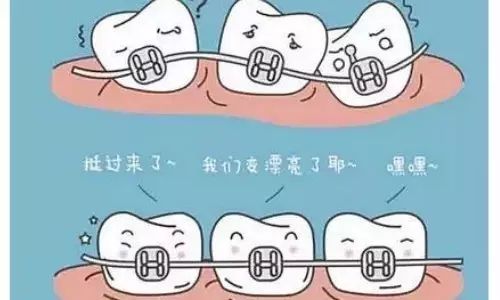 已经30岁能做牙齿矫正吗？