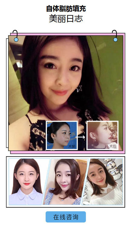 ˮ֬ʼ۸