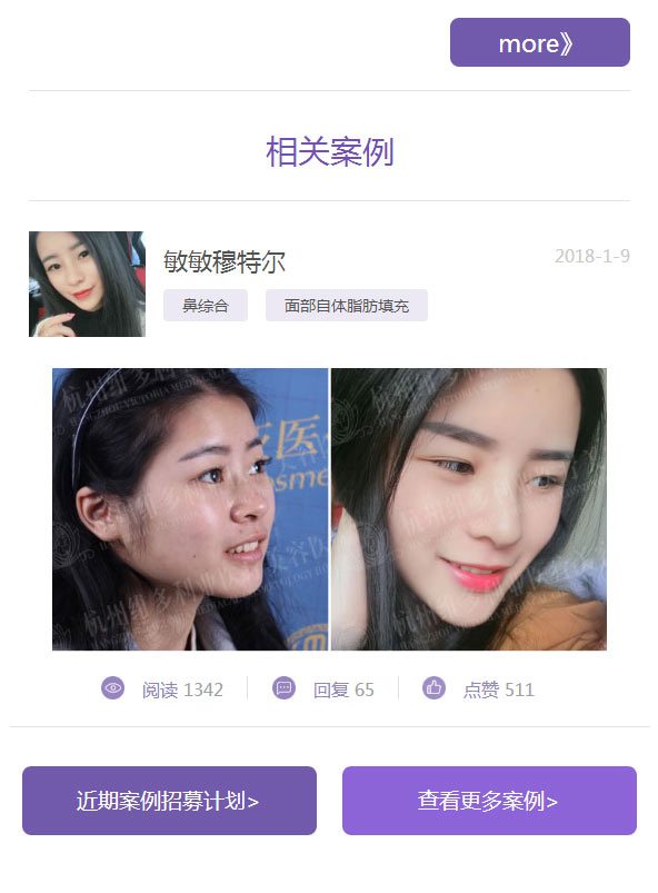 ǰ仯ж