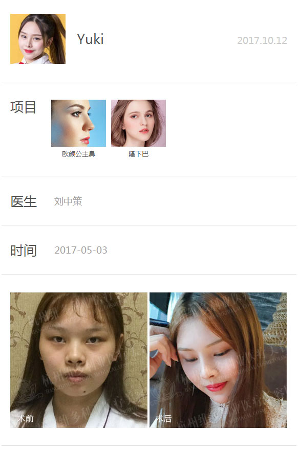 Yuki沿ǰЧԱȣ