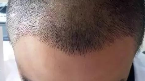 ݷֲƼ