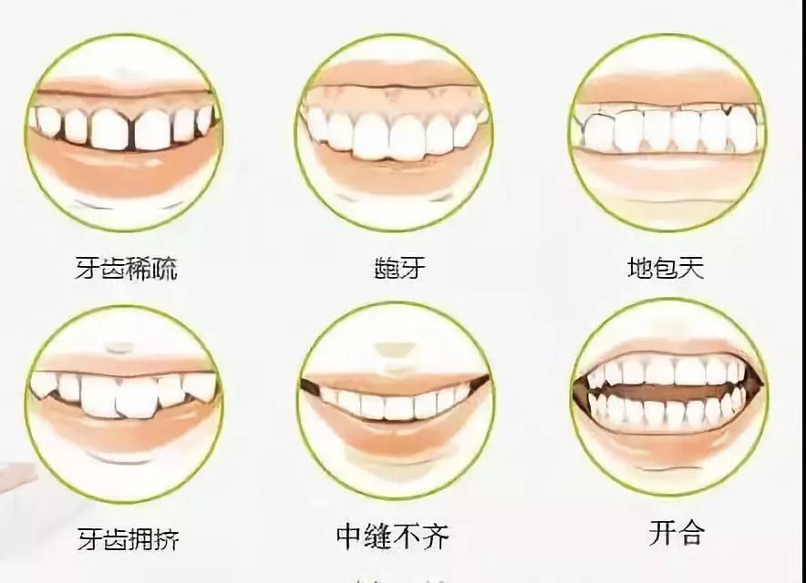 杭州哪里做牙齿矫正专业