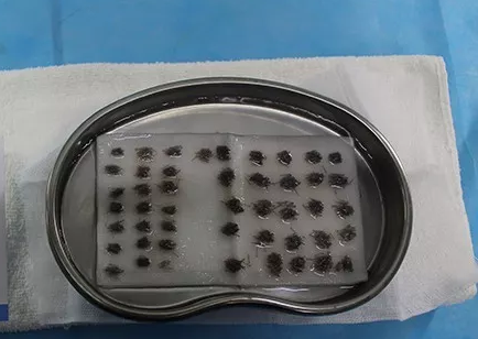 ݾ침ֲ